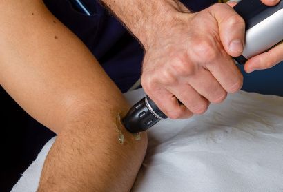 Le onde d'urto in fisioterapia: Cosa sono e come funzionano
